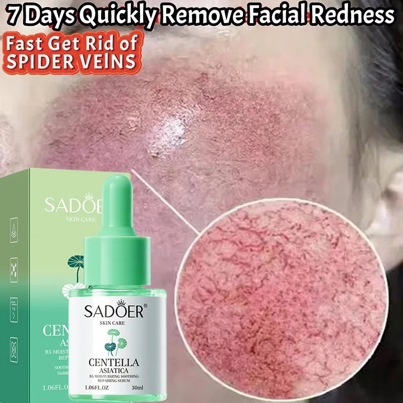 Facial Redness Repair Serum Improve Sensitive Skin Dryness Moisturizer Hydrating Sooth Lotion Removal Rosacea Korean Cosmetics