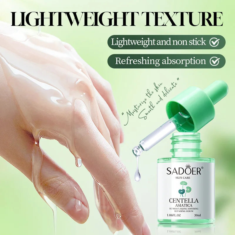 Facial Redness Repair Serum Improve Sensitive Skin Dryness Moisturizer Hydrating Sooth Lotion Removal Rosacea Korean Cosmetics